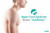 Upper Cross Syndrome โรคของคนหลังค่อม