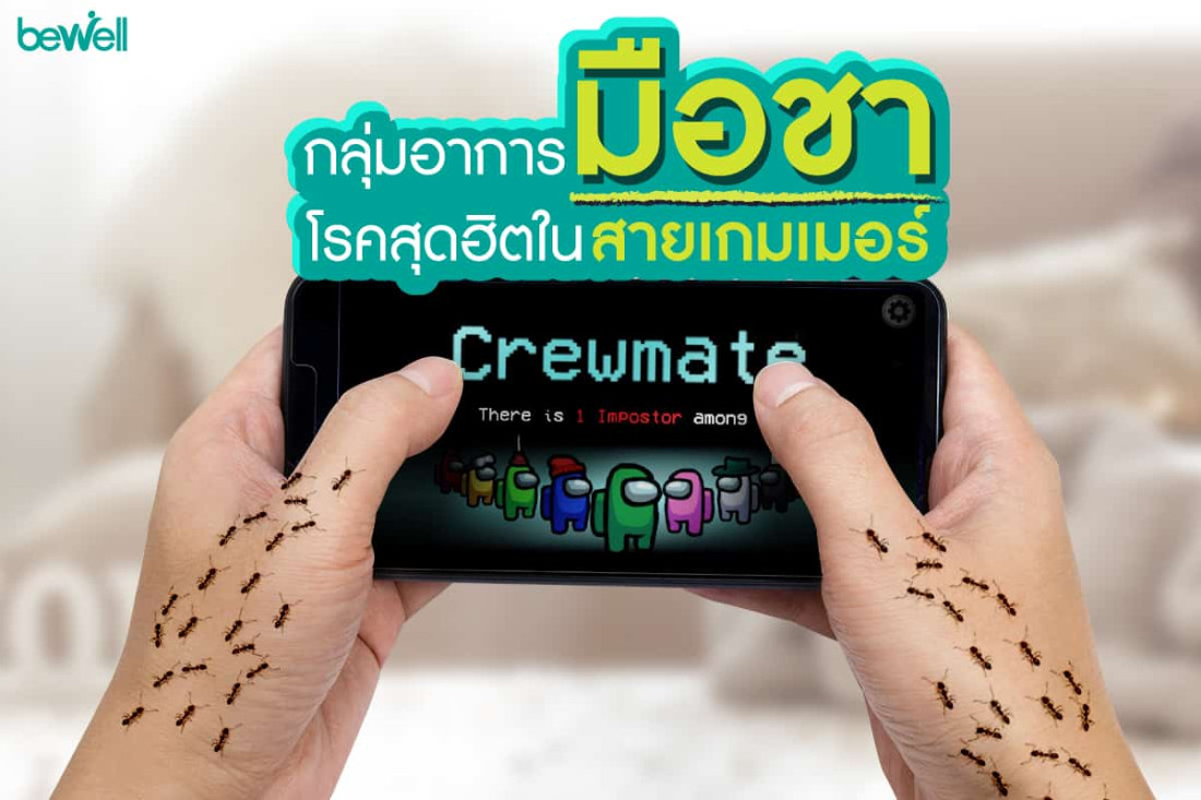 กลุ่ม"อาการมือชา" โรคสุดฮิตในสายเกมเมอร์