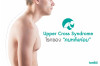 Upper Cross Syndrome โรคของคนหลังค่อม